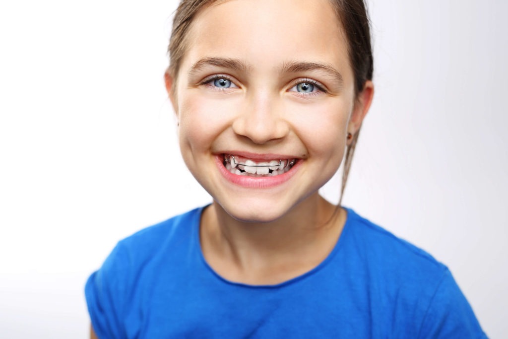 kids braces