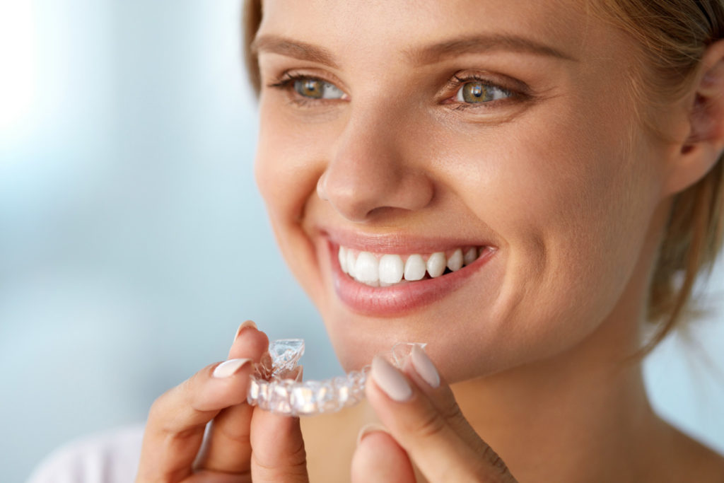 How To Maintain Your Smile After Braces